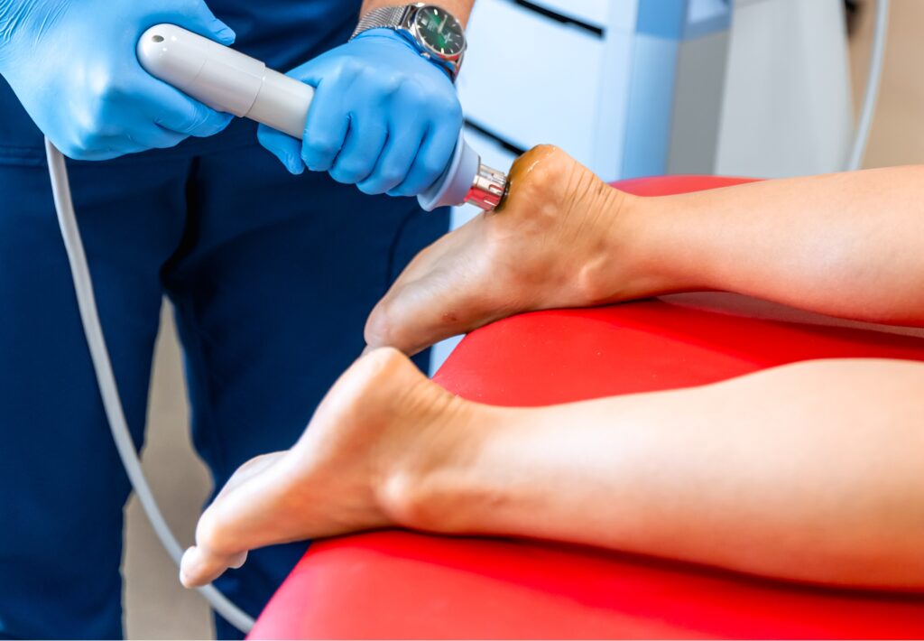 patient getting non surgical treatment with shock waves for plantar fasciitis.